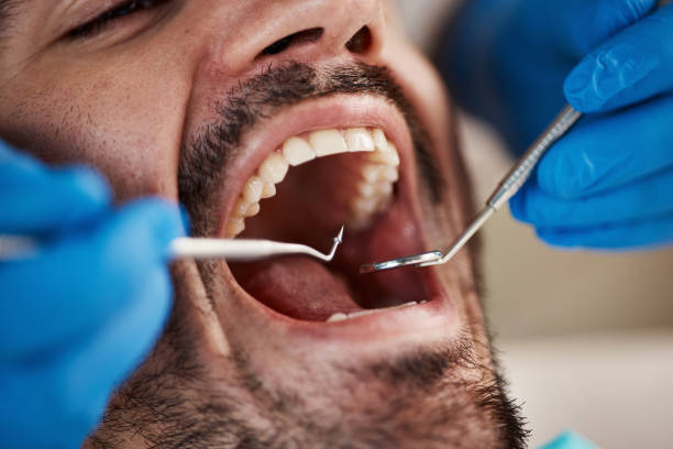 Best After-Hours Emergency Dentist in Maggie Valley, NC